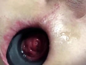 Anal gaping anal prolapsing anal vacuum pumping compilation